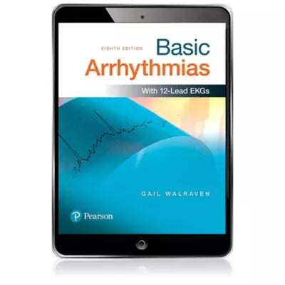 Basic Arrhythmias
